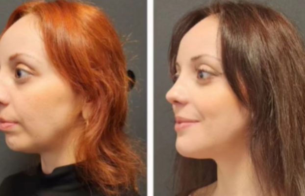 Orthodontic Treatment Benefits 2026 (Editted and Extended)