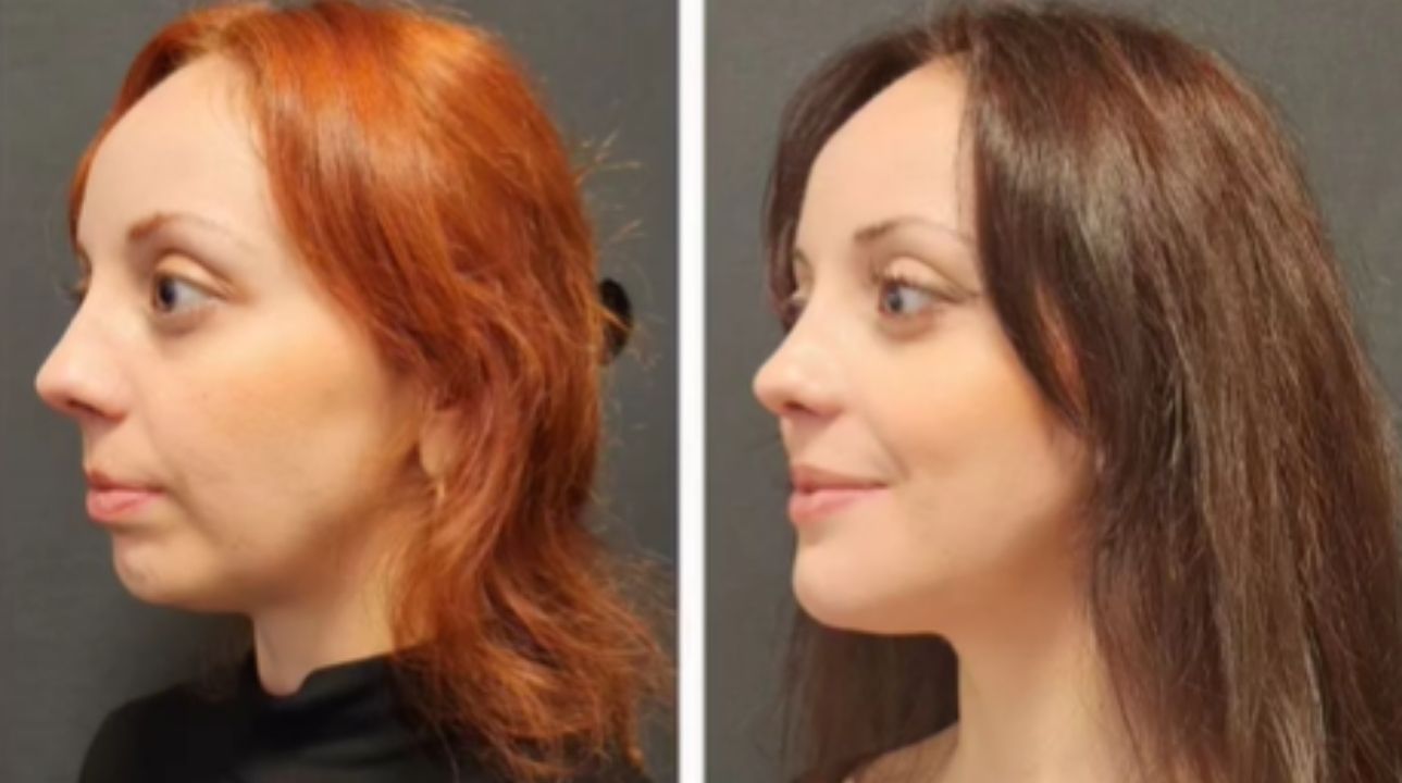 Orthodontic Treatment Benefits 2026 (Editted and Extended)