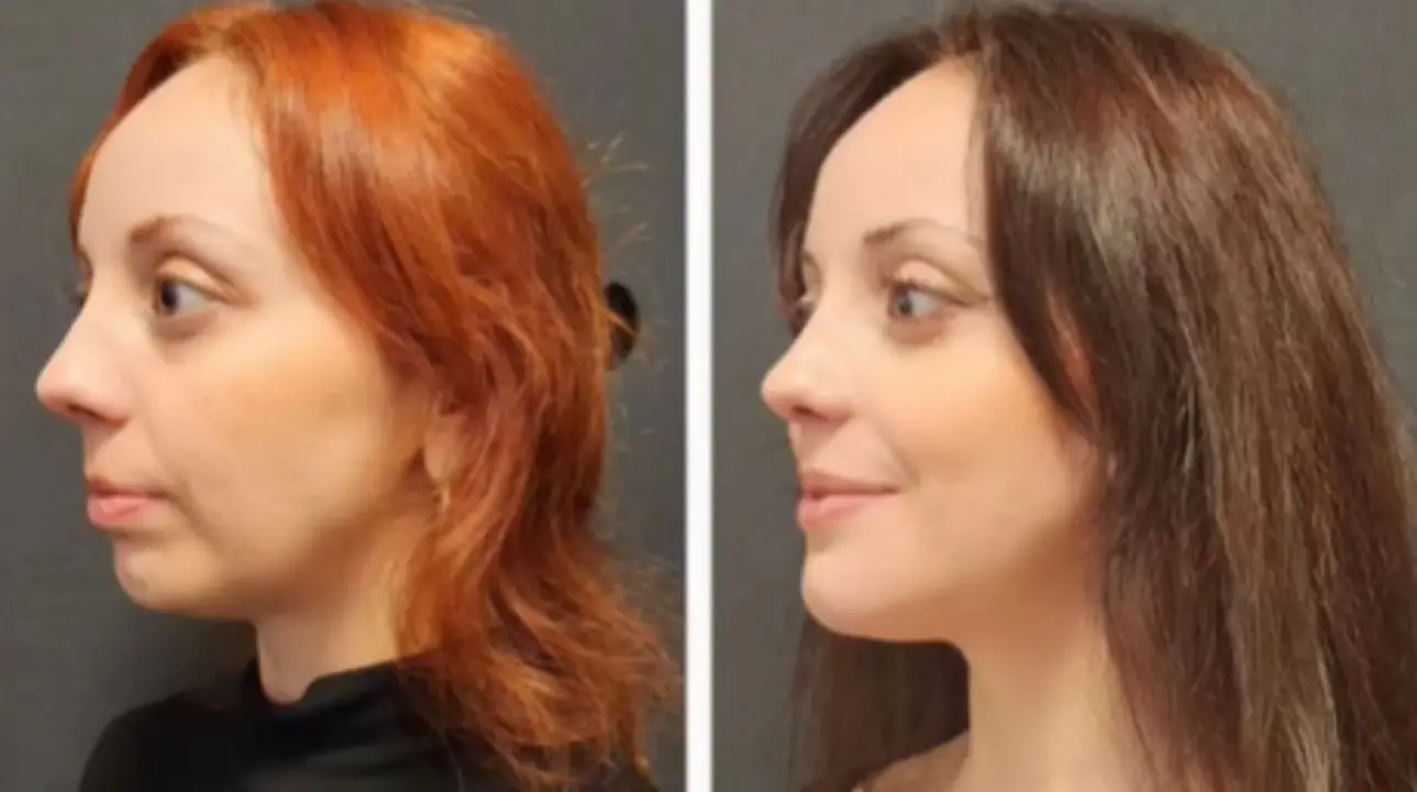 Orthodontic Treatment Benefits 2026 (Editted and Extended)