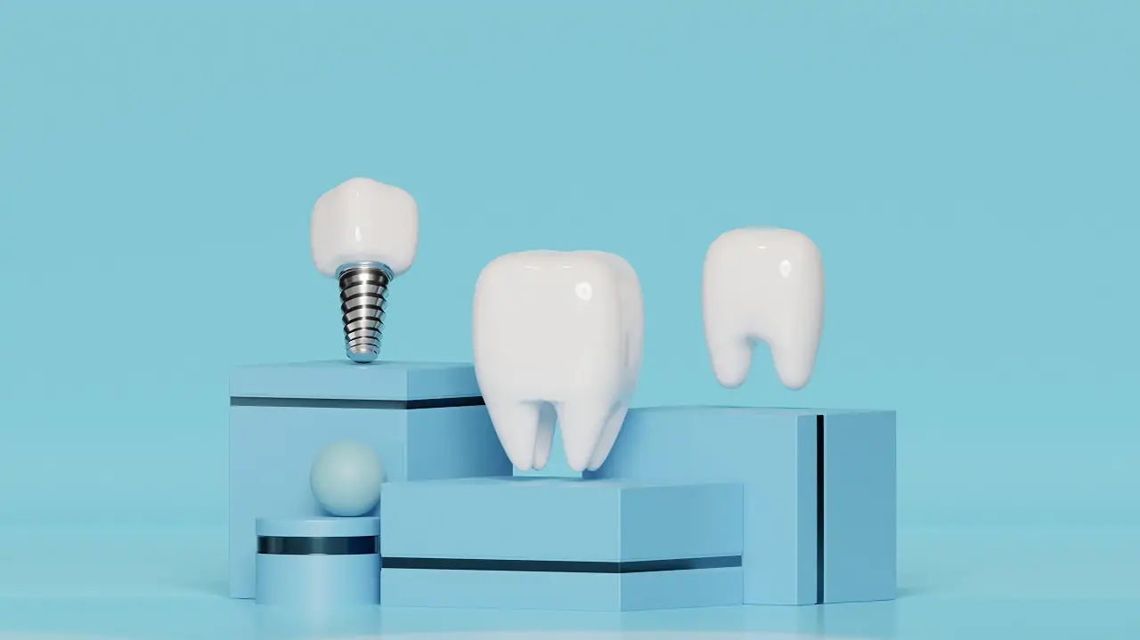 dental-implant-healing-time