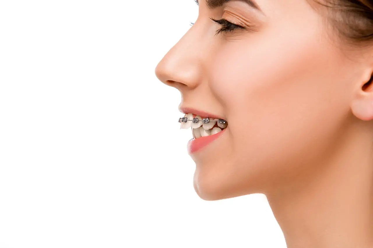 about-before-and-after-corrective-jaw-surgery-processes