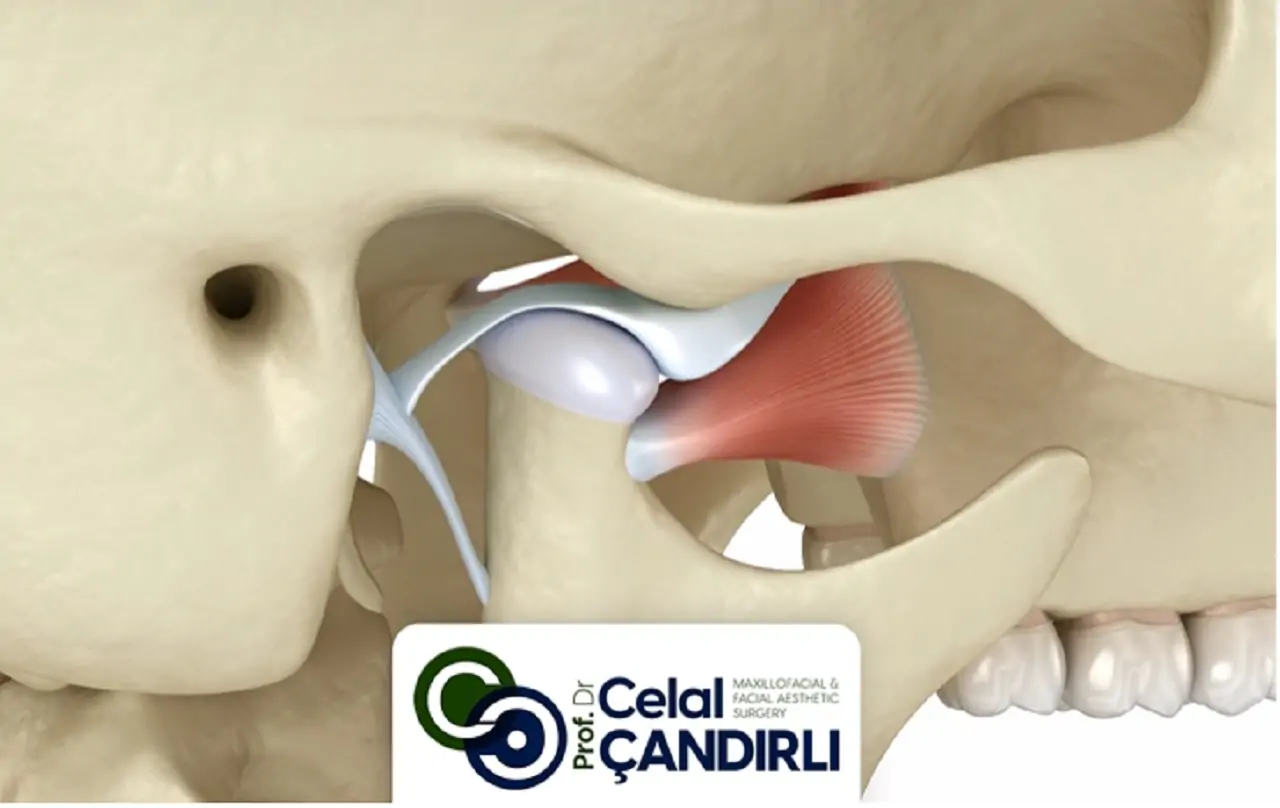 double-jaw-surgery-before-and-after