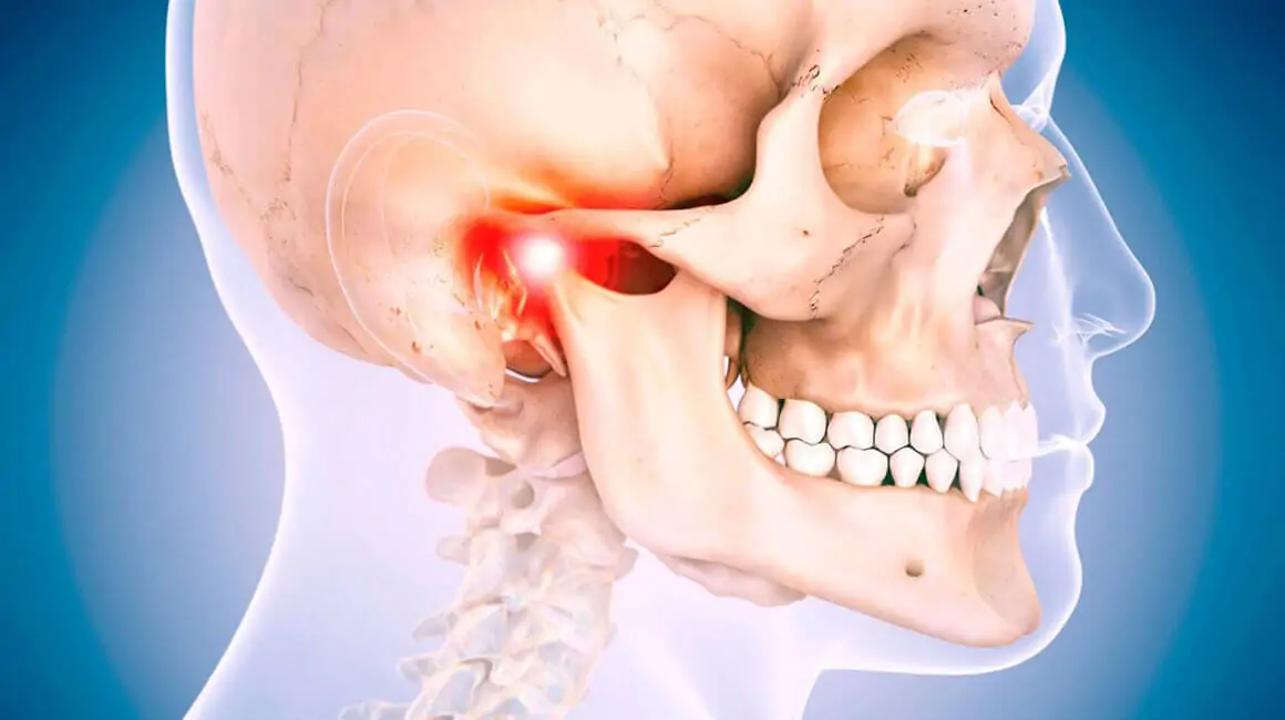 jaw-joint-replacement-surgery