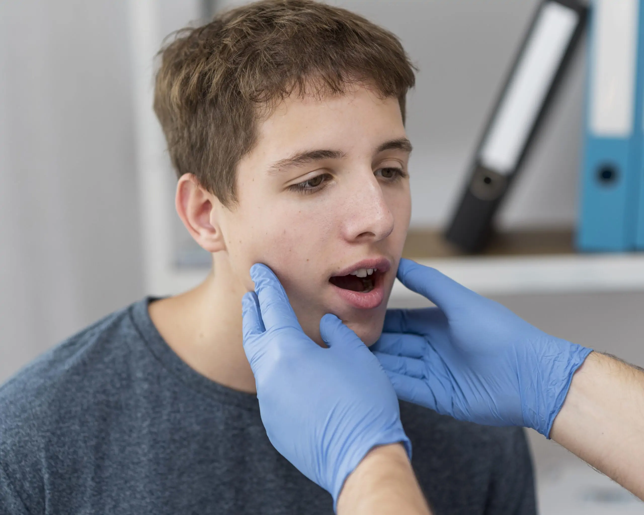 before-and-after-jaw-surgery-overbite