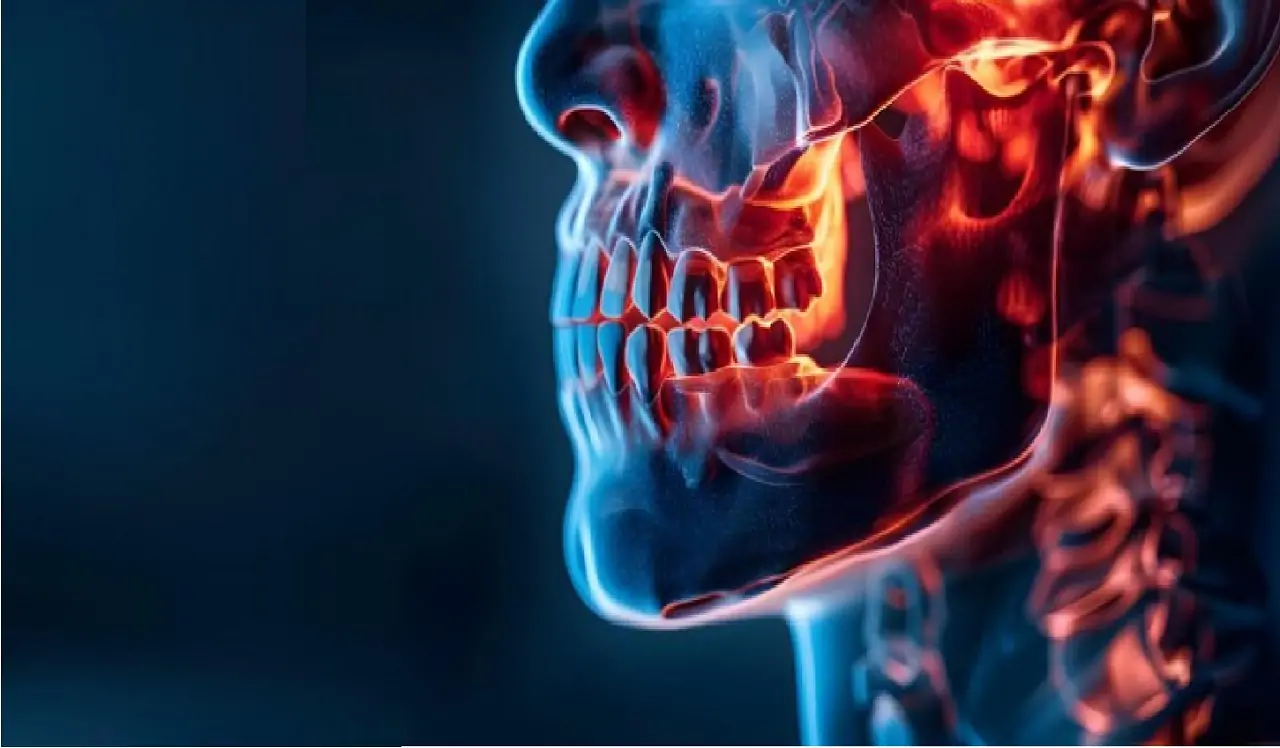 Temporomandibular Joint Surgery at Celal Candirli Clinic