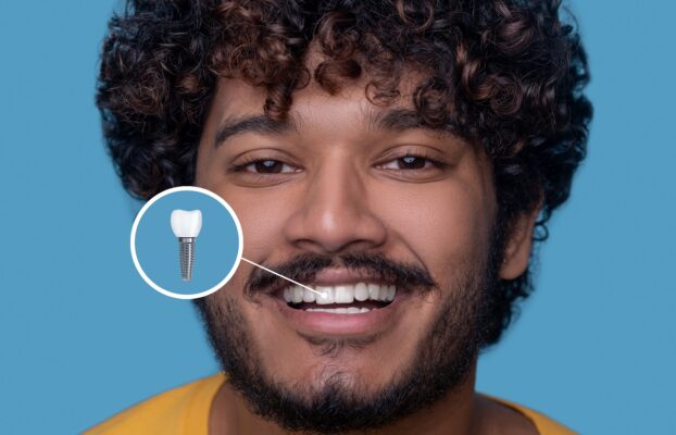 2026 Zygomatic Implant Prices