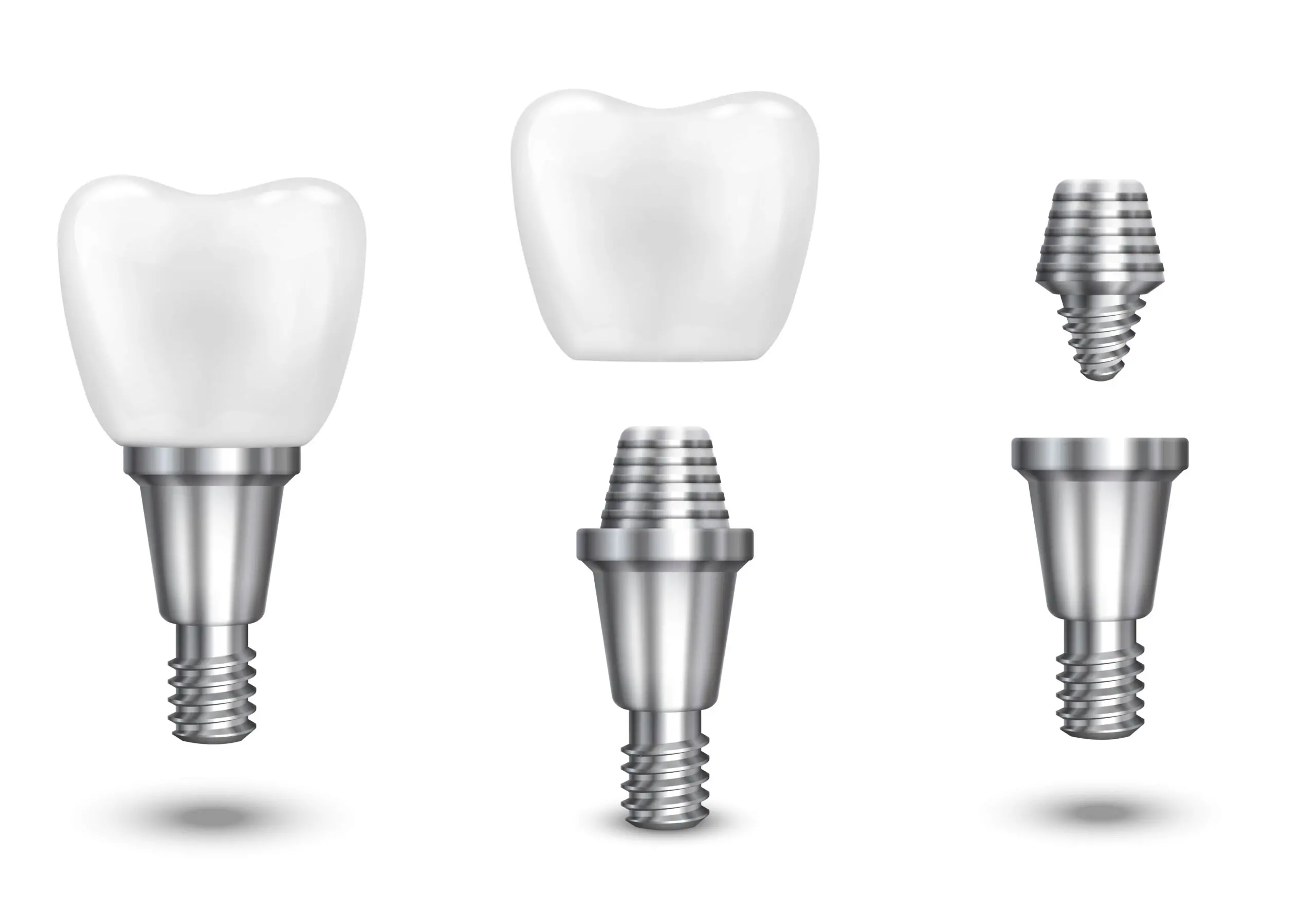 metal-implantlarla-yüz-cerrahisi