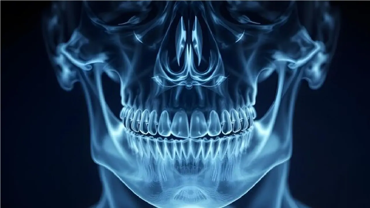 orthognathic-jaw-surgery-before-and-after