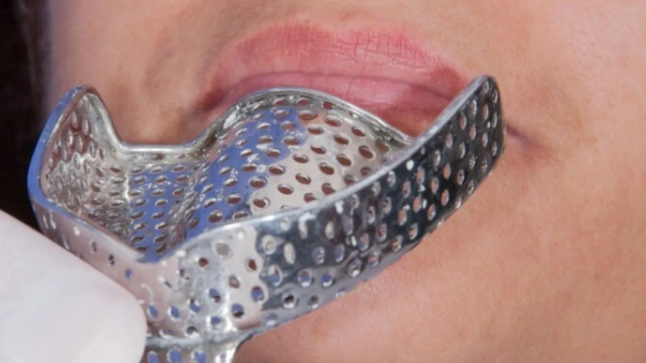 what-are-metal-implants-in-facial-surgery (1)