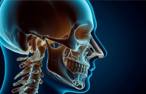 Zygomatic Implant Procedure in 5 Steps