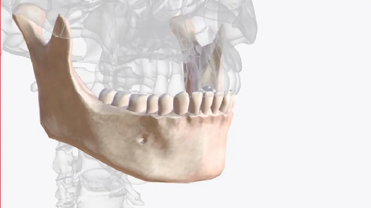 zygomatic-implant-procedure-in-5-steps-3