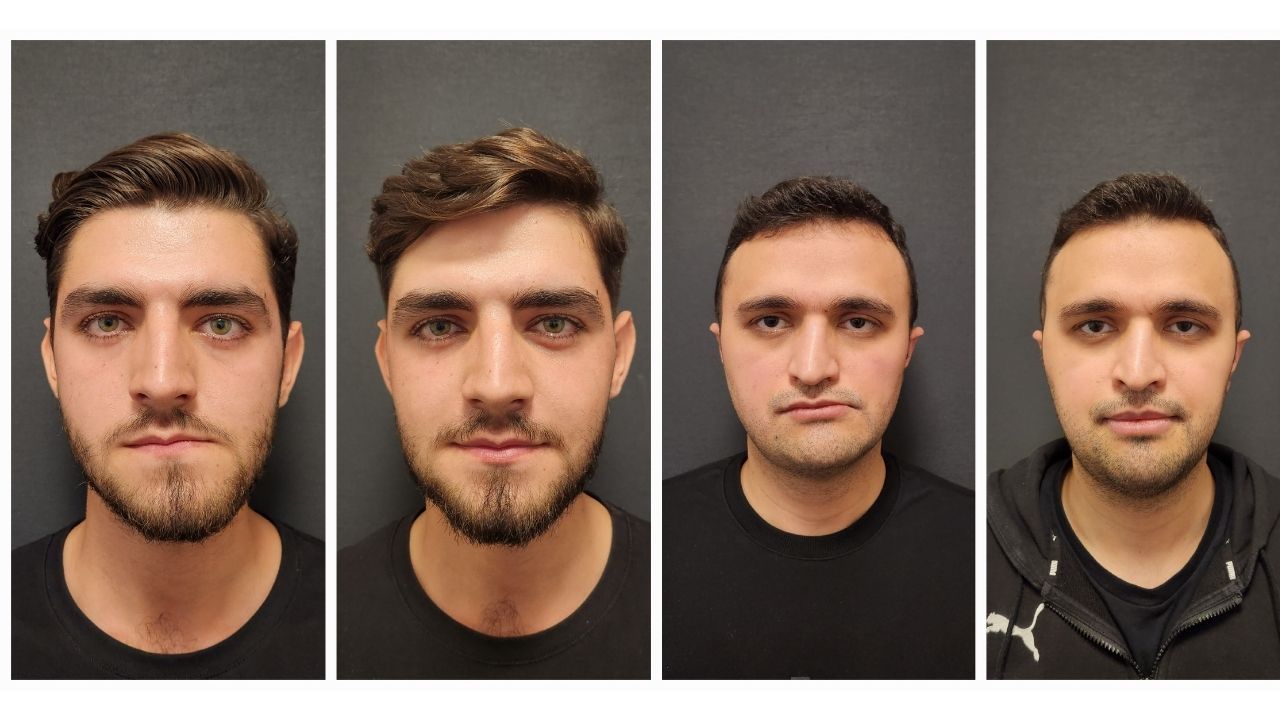Which Country is the Best for Double Jaw Surgery?
