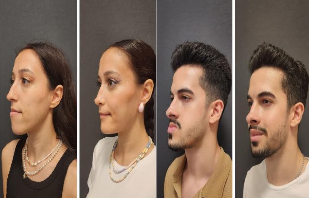 How Much Does A Jawline Implant Cost?