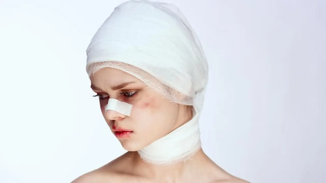 Fractured Cheekbone 