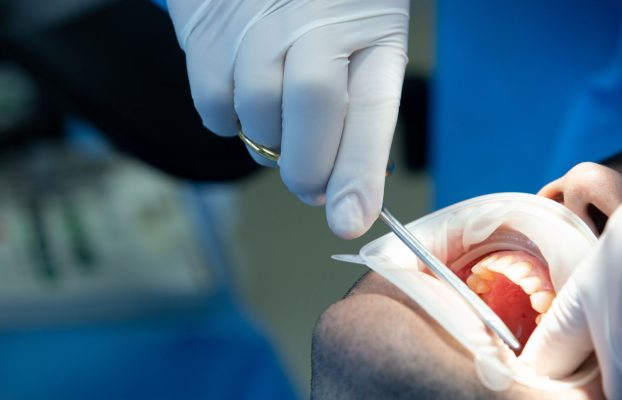 Çene Cerrahisinde Kullanılan Modern Yöntemler ve Çene Cerrahisi Teknolojileri (2025 Güncel)