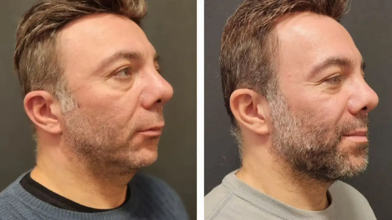 What Affects the Cost of Maxillofacial Surgery?